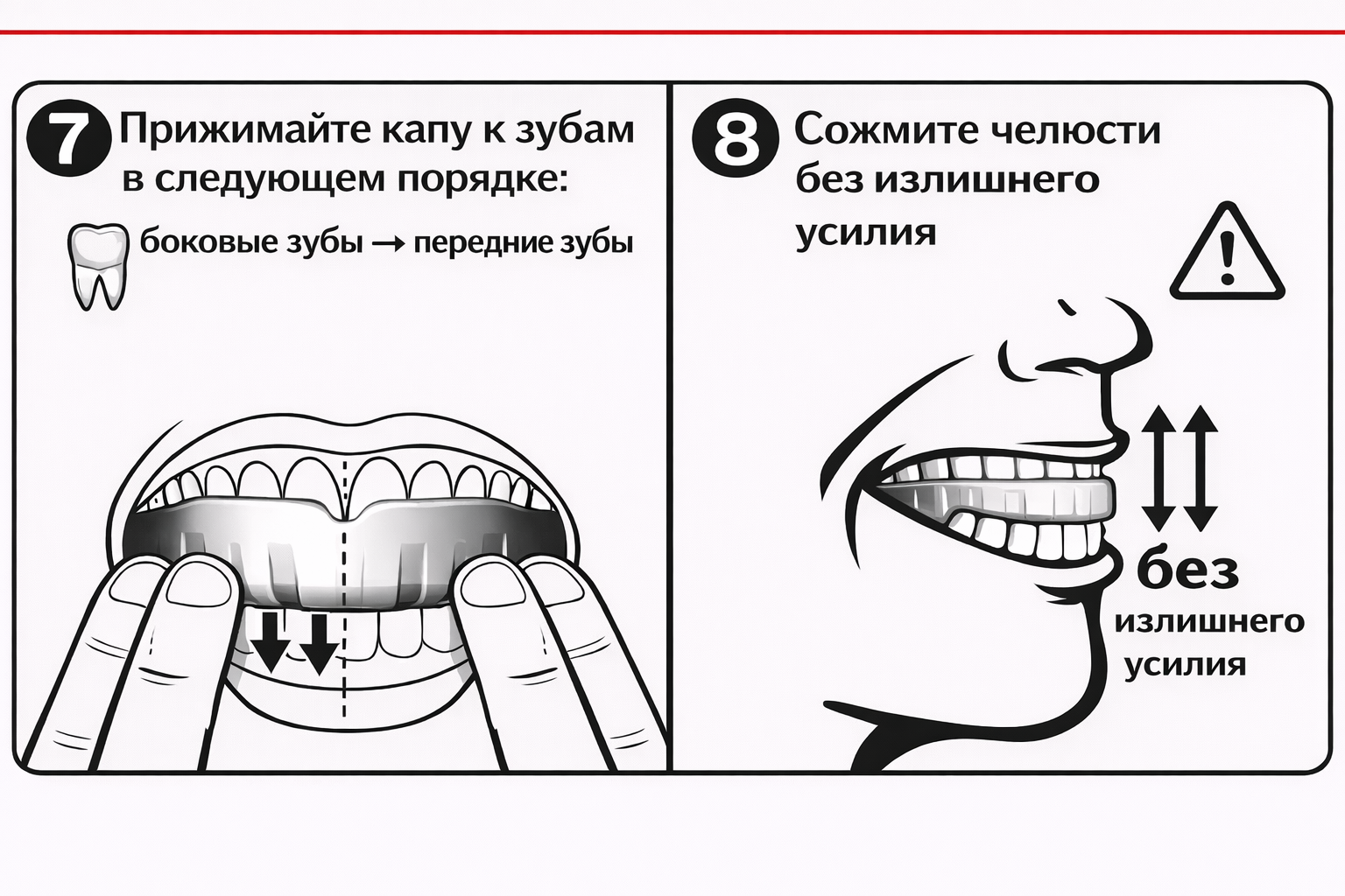 Прижмите капу к зубам и сожмите челюсти